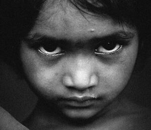 Nicht nur Kindern leider von unter der dramatischen Situation in Syrien (Bildquelle: photocase.com // peter4)